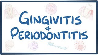 Gingivitis and periodontitis  causes symptoms diagnosis treatment pathology [upl. by Lerner]