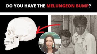 5 Common Traits of Melungeon Descent [upl. by Margalit]