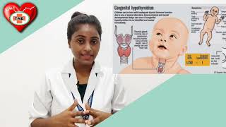 बच्चों में थायराइड के लक्षण Congenital Thyroid [upl. by Ynnavoeg774]