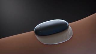 90day Senseonics Eversense Continuous Glucose Monitor Promotional Video [upl. by Nevai]