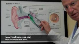 quotTreatable Causes of Hearing Lossquot Hearing Loss Newton MA Part 2 [upl. by Eisej]