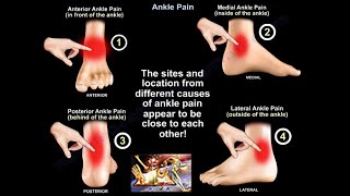 Ankle Pain  Everything You Need To Know  Dr Nabil Ebraheim [upl. by Yentrac]