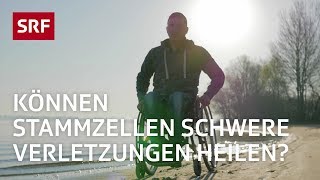 Stammzellen Ein Wundermittel der Medizin  Erklärvideo  SRF [upl. by Nwadrebma]