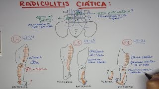 Cómo Arreglar la Protusión Discal L45 y L5S1 RÁPIDO ALIVIO [upl. by Hairom]