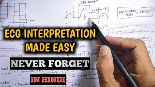 ECG interpretation made easy  How to read ECG in hindi [upl. by Enelrats658]