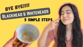 5 Hacks to get Rid of Blackheads in 1 day simple hacks homeremedies skincare [upl. by Akired]