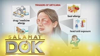 Salamat Dok Causes and symptoms of urticaria [upl. by Mella]