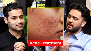 Pimple amp Acne Treatment  DO THIS  Dermatologist  Dr Gurjot Marwah  Raj Shamani Clips [upl. by Aicelaf993]