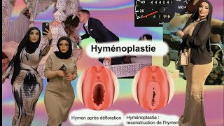 hyménoplastie musulmane elle ment sur leur virginité et se moque de lhonneur du marié islam [upl. by Weatherby72]