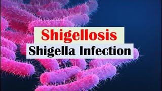 Shigellosis Shigella “A Cause of Bloody Diarrhea” Pathophysiology Symptoms Diagnosis Treatment [upl. by Fraze]