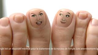 Emtrix® Traitement mycose des ongles ➧ Emtrix des résultats visibles dès la première semaine [upl. by Segal]