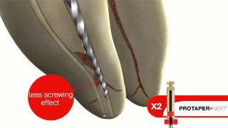 DENTSPLY ProTaper Next [upl. by Chaffin]