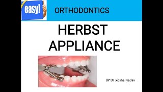 HERBST APPLIANCE ORTHODONTICS [upl. by Aleacin738]