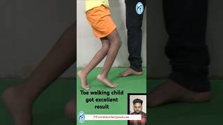 Cerebral Palsy child from Bangladesh Affected with jump knee gait got excellent recovery shorts [upl. by Ynaffik]