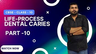 Life Processes Class 10 Science Biology  Lecture10  CBSE Board  Devendra Sir [upl. by Elsey]