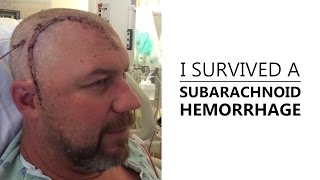 I Survived A Subarachnoid Hemorrhage [upl. by Vento]