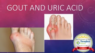 Gout and Hyperuricemia [upl. by Moia]