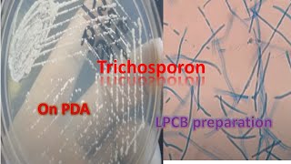 Trichosporon on SDA and LPCB preparation under the microscope [upl. by Airol777]