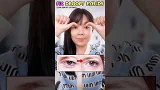 Fix Droopy Eyelids without surgery  Eyelids Lift Exercise [upl. by Oigolue857]