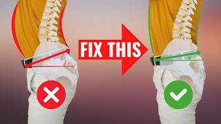 FIX Anterior Pelvic Tilt in 100 Seconds for PERFECT Posture [upl. by Sheffy]