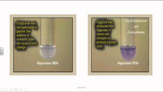 Group B Streptococci or Streptococcus Agalactia [upl. by Wendel531]