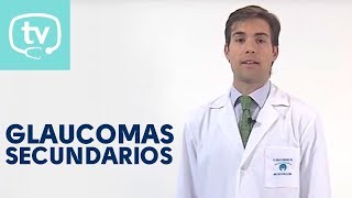 Los glaucomas secundarios [upl. by Atalanti]