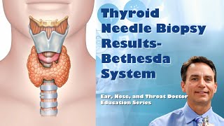 Thyroid Needle Biopsy Results  Bethesda Classification System [upl. by Rouvin]