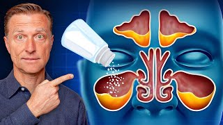 Rid Throat and Sinus Mucus with SALT [upl. by Nitsu]