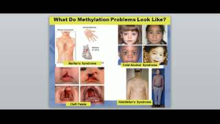 Physical Signs of Methylation Problems [upl. by Htiel]