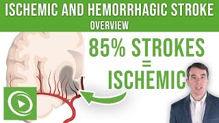 Overview of Ischemic and Hemorrhagic Stroke  Lecturio [upl. by Zillah261]