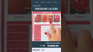 Pressure Ulcers Explained Nursing Cheat Sheet shorts NCLEX nursingschool NCLEXprep nursing [upl. by Jezrdna]