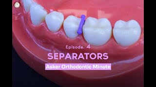 Separators Asker Orthodontic Minute Episode 4 [upl. by Ashok]