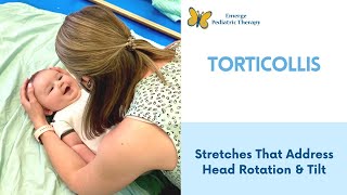 Torticollis 2 Stretches To Try At Home [upl. by Hatokad]