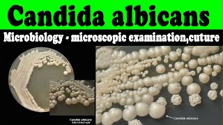 Candida albicans microbiology  microscopic examinationcuturelaboratory diagnosis [upl. by Arabela]