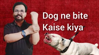 Dog bite kar le to kaise chudwaye as a dog Owner dog bite kr le to kya kre [upl. by Glasgo]