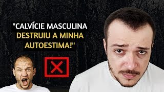 A CALVÍCIE MASCULINA ESTÁ ACABANDO MEU LADO EMOCIONAL [upl. by Inavoj588]