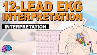 The SIMPLE Steps of 12Lead EKG Interpretation  EXPLAINED CLEARLY [upl. by Yreme]