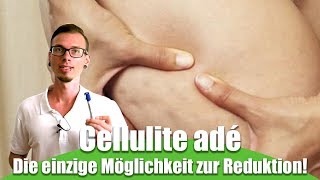 Cellulite adé  Der einzige Weg um Cellulite los zu werden [upl. by Canica]