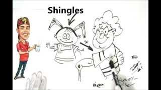 Shingles Explained Simply [upl. by Cointon909]