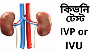 IVP or IVU kidney test কিডনি টেস্ট IVP or IVU [upl. by Nosidda669]