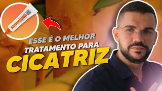 MELHOR TRATAMENTO PARA CICATRIZ QUELOIDE [upl. by Lekim278]