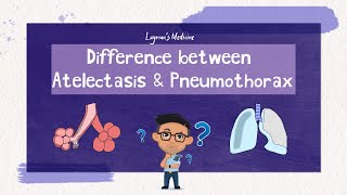 Atelectasis vs Pneumothorax atelectasis pneumothorax [upl. by Nitsid]