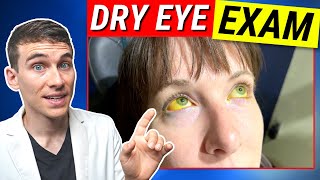 The Most Thorough Dry Eye Examination  Dry Eyes Testing Explained [upl. by Einafets284]