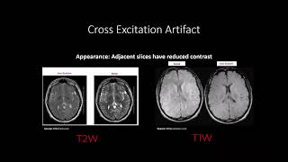 MRI Artifacts and their Compensation [upl. by Eimor]