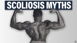 5 Facts You NEED to Know About Scoliosis Best Exercises Back Pain Performance and More [upl. by Otrebide]