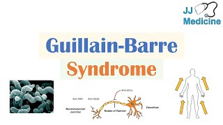 GuillainBarré Syndrome GBS  Causes Pathophysiology Signs amp Symptoms Diagnosis Treatment [upl. by Droffig]