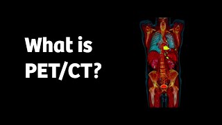 What is PETCT and how does it work [upl. by Ellerahc]