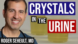 Review of Crystals Found in the Urine for Kidney Stones [upl. by Yasnil]