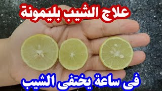 ليمونة واحدة تخلصك من الشيب حتي لو الشعر كله ابيض علاج الشيب والشيب المبكر [upl. by Ymor438]