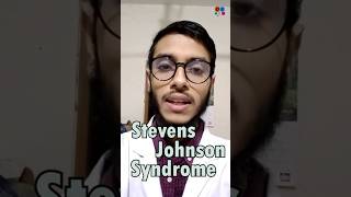 Stevens Johnson Syndrome  Sulfonamide  Penicillin  Antibiotics  Adverse effects [upl. by Balbur]